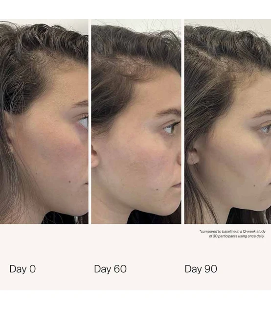 Living Proof Scalp Care Density Serum 50ml  | Celini.nl